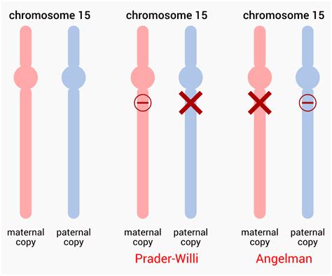 prader willi syndrome dna